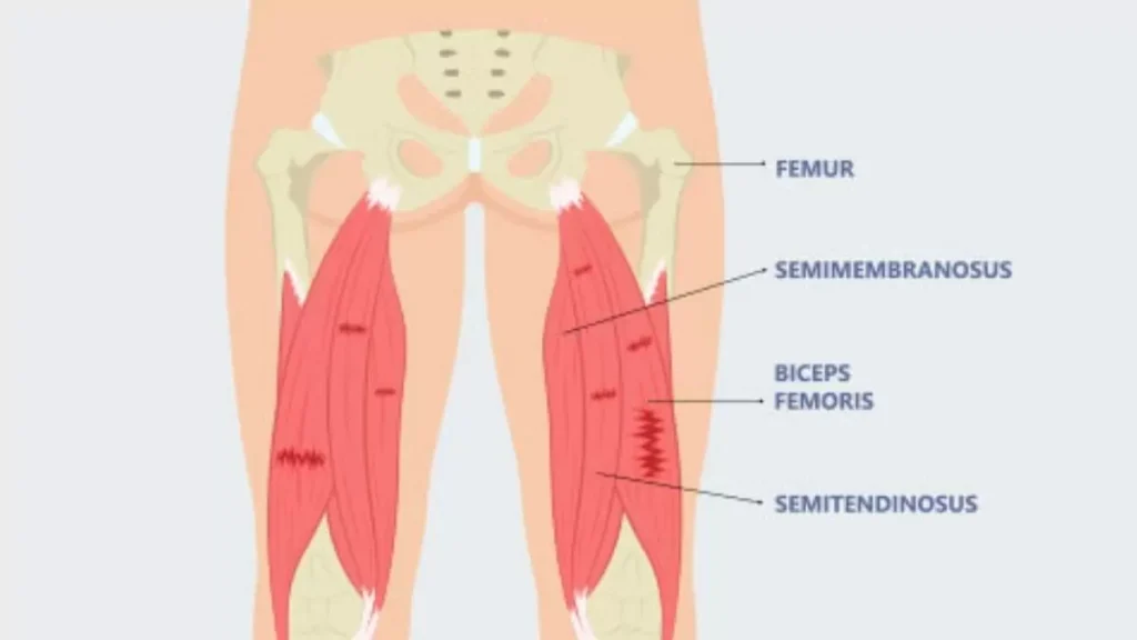 Hamstring anatomy