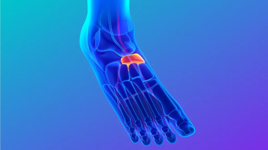 Navicular stress fractures
