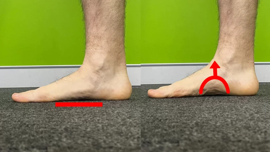 Tibialis posterior retraining arch raises