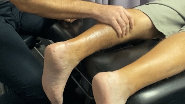 Achilles rupture diagnosis