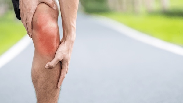 Patellofemoral pain syndrome