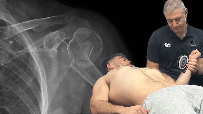 Shoulder assessment