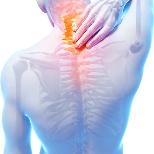 kisspng neck pain myofascial pain syndrome muscle pain